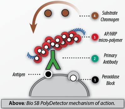 PolyDetector IHC — Sistema de Detección por Micropolímero Fab