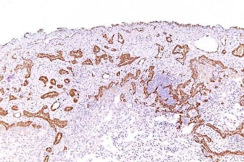 Anticuerpo Monoclonal Calretinina