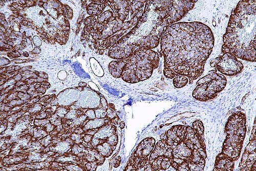Anticuerpo Monoclonal CD31 (PECAM-1)