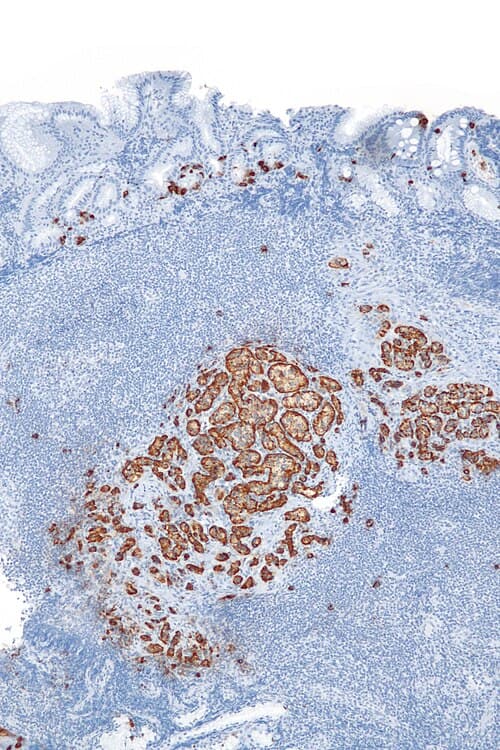 Anticuerpo Monoclonal Cromogranina A