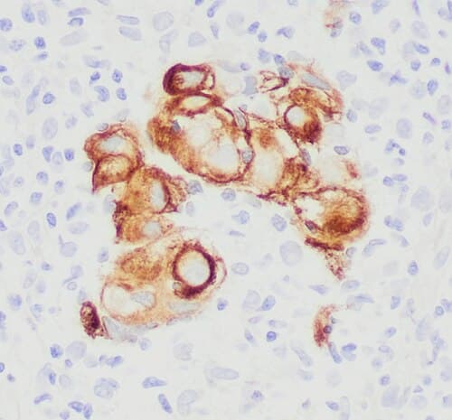 Anticuerpo Citoqueratina 7 (CK7)