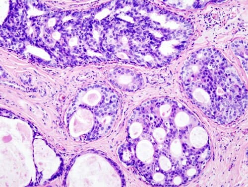 Anticuerpo Receptor de Estrógenos (ER) — SP1
