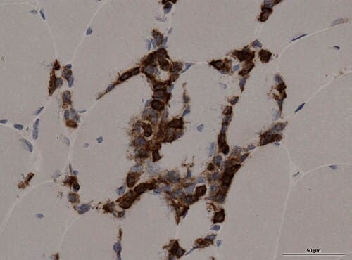 Anticuerpo Monoclonal CD45 / LCA