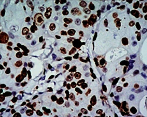 Anticuerpo Monoclonal KI-67 (MIB-1)