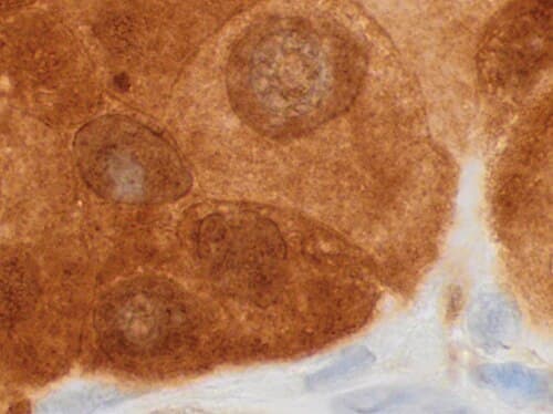Anticuerpo HER-2/neu (c-erbB-2)