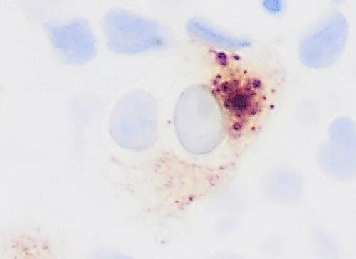 Anticuerpo Receptor de Progesterona (PR)