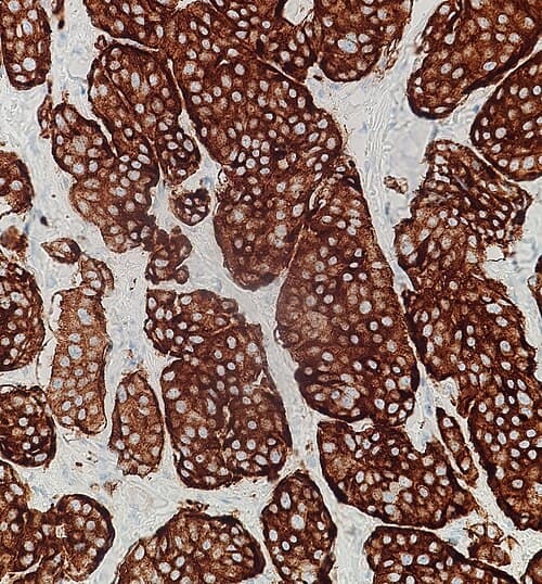 Anticuerpo Monoclonal Sinaptofisina