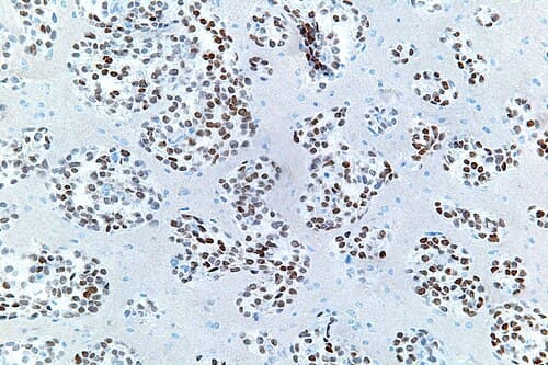 Anticuerpo Monoclonal TTF-1 (NKX2-1)