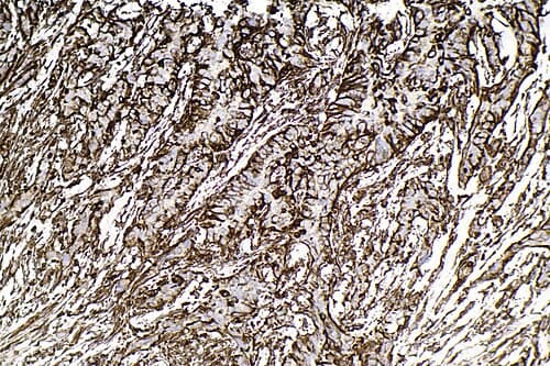 Anticuerpo Monoclonal Vimentina